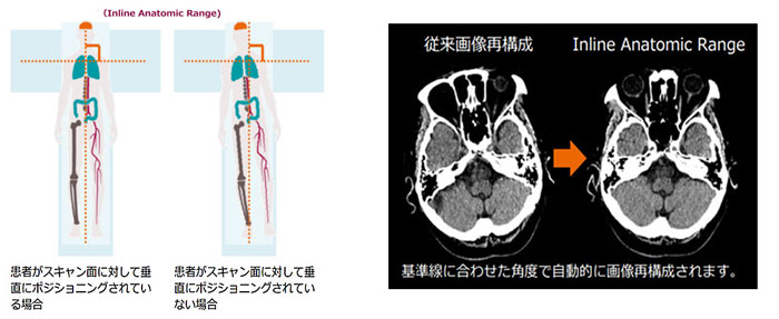 CTの画像