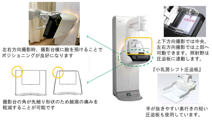 マンモグラフィ機器の画像