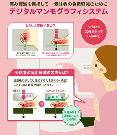 デジタルマンモグラフィシステム案内の画像