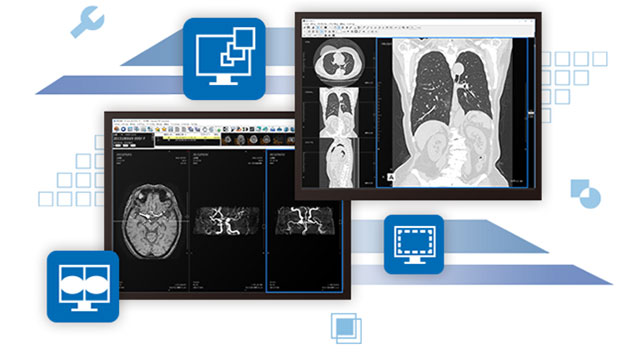 DICOMビューアーソフトウエアの画像