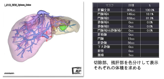 画像処理と作成された画像