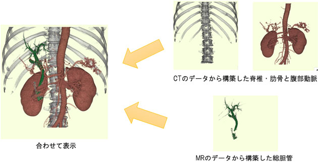 フュージョンの画像